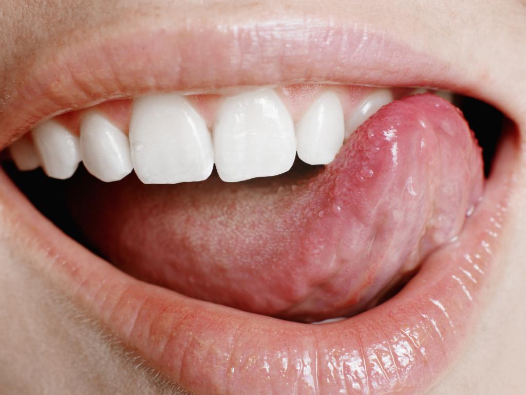 Прищики в роті у дорослих   причини появи та лікування