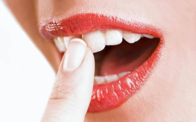 Що робити, якщо почали хитатися зуби у дорослих: причини і лікування