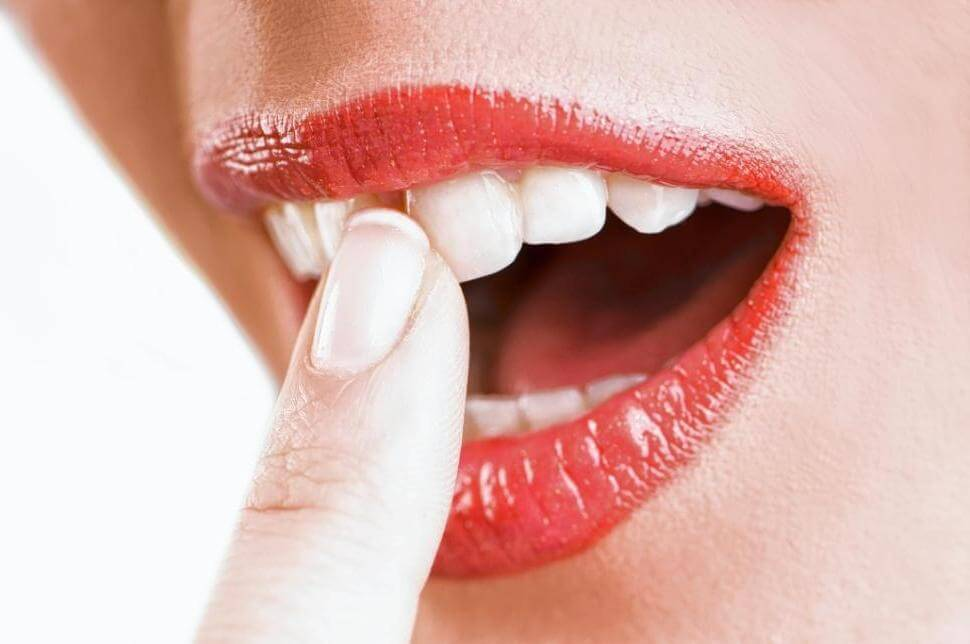Як зміцнити хитаючийся зуб в домашніх умовах: причини і методи лікування