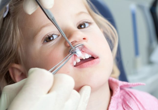 Чому не випадають молочні зуби у дитини: причини