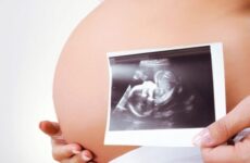 Терміни проведення третього скринінгу при вагітності (29 фото): у скільки тижнів його роблять і що дивляться, норми показників і розшифровка результатів