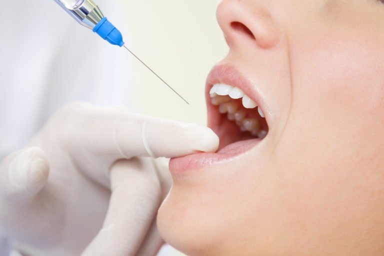 Видалення зубів під час вагітності: відгуки експертів
