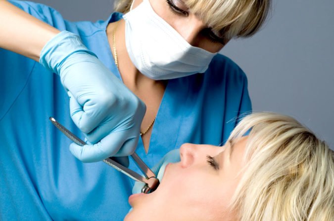 Чим можна обробити десну після видалення зуба – мазі, полоскання