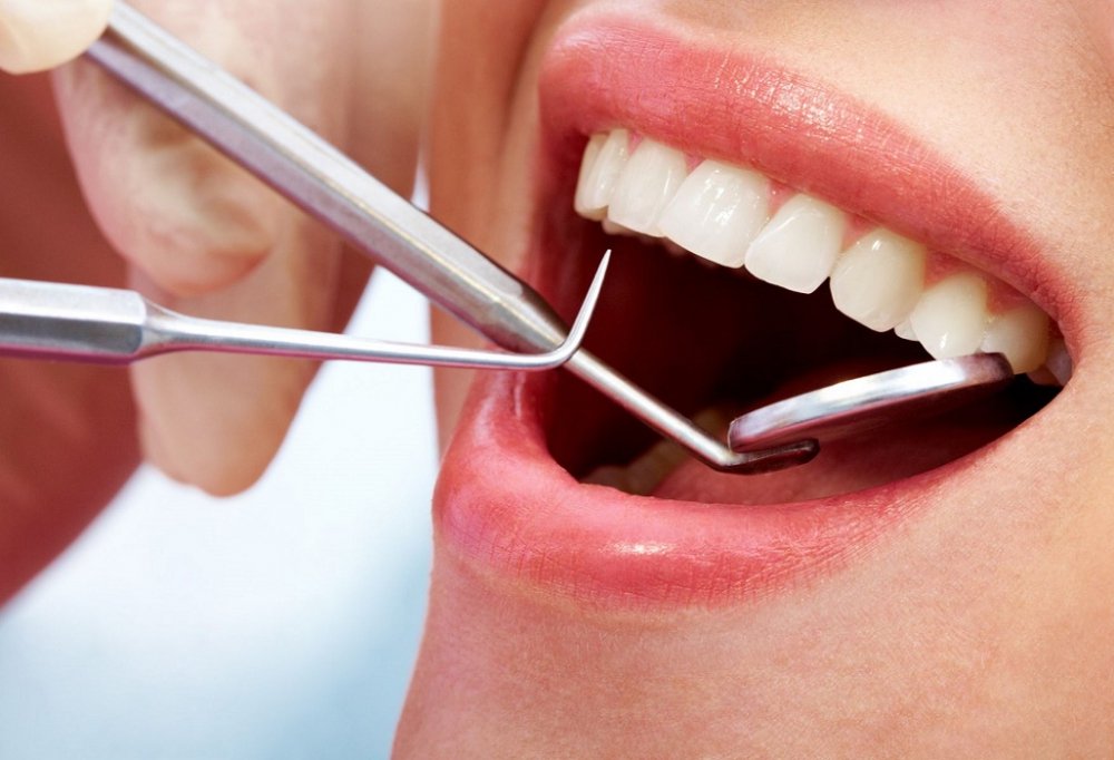 Які зубні протези краще поставити: поради фахівців