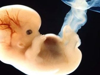 Узд на 4 тижні вагітності (29 фото): чи можна робити, розмір плоду, що видно через 3 тижні після зачаття