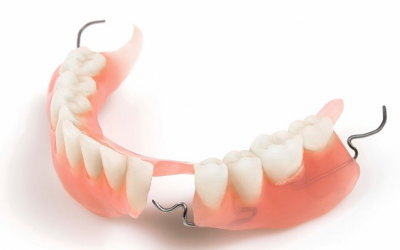 Догляд за зубними протезами з пластмаси на гачках: правила чищення та харчування