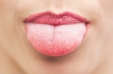 Який лікар лікує язик: до якого спеціаліста слід звернутися