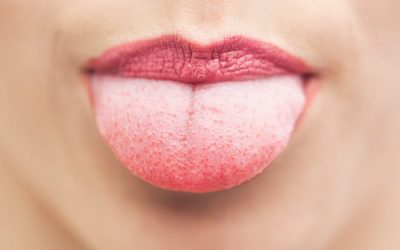 Який лікар лікує язик: до якого спеціаліста слід звернутися