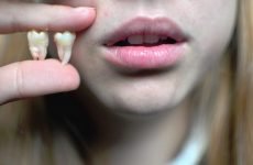 Боляче видаляти зуб мудрості: як проводиться анестезія?