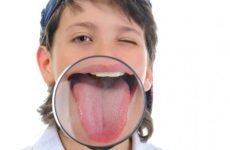 У дитини коричневий наліт на язиці: причини і методи лікування