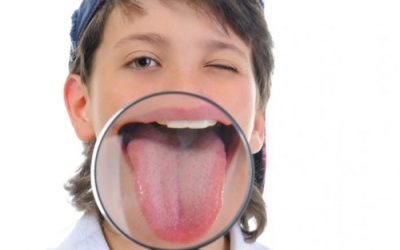 У дитини коричневий наліт на язиці: причини і методи лікування