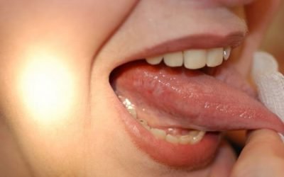 Хвороби язика: причини, симптоми, методи діагностики та лікування
