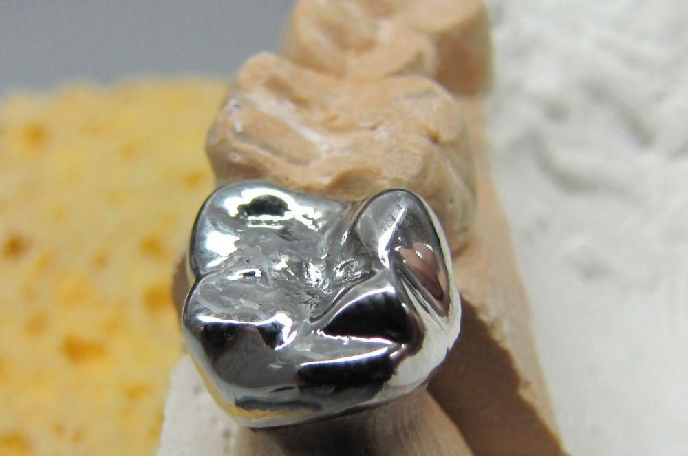 Штампованные коронки на зубы. Коронка цельнолитая (сплав remanium). Цельнолитые металлические мостовидные протезы. Штампованные и цельнолитые коронки. Металлические коронки штампуются из сплава.