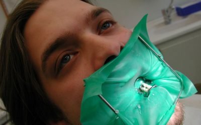 Коффердам в стоматології: переваги та недоліки, особливості застосування