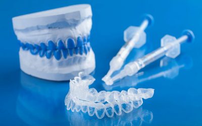 Капи для відбілювання зубів: різновиди, переваги і недоліки