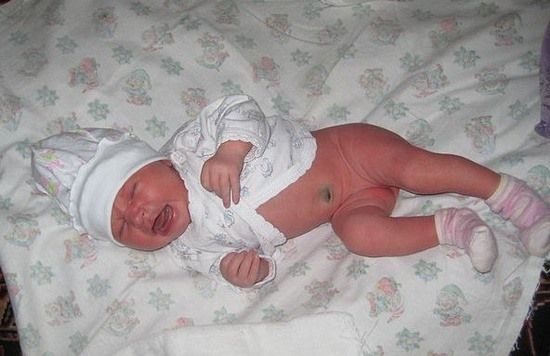2 недели от рождения. Ребенок новорожденный обкакался. Первые дни новорожденного. Новорожденная девочка без памперса. Чтобы новорожденный покакал.