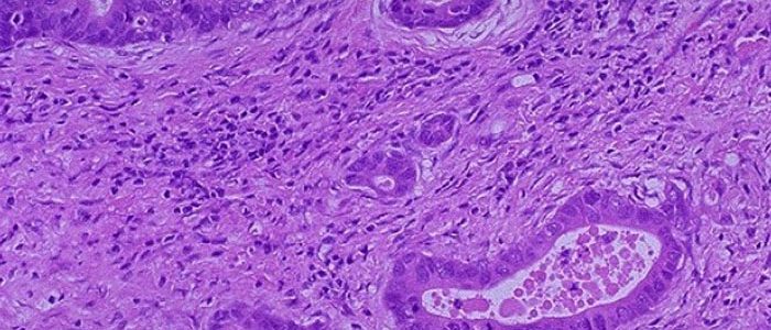 5e310e1bc5095d41510a7b50e13a942d