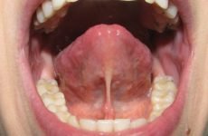 Болить під язиком: причини появи болю та методи лікування