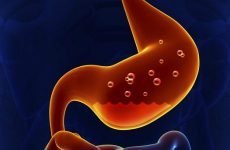 Як підвищити кислотність шлунка: продукти, народні засоби, препарати
