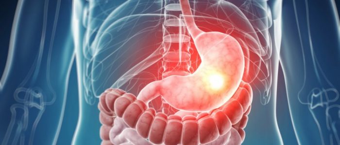 a6e12c79f0814c21cb910f5275c908b1