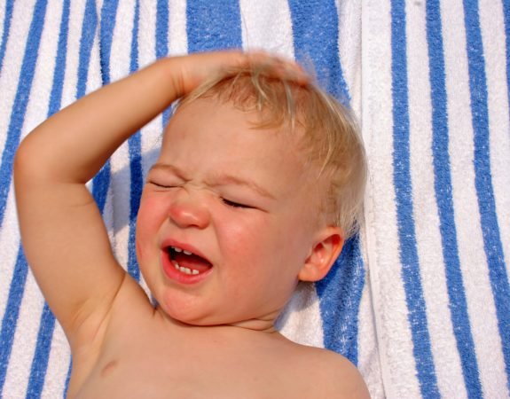 Що робити, якщо дитина перегрівся на сонці? Перша допомога і лікування при перегріві, сонячних опіках і ударах