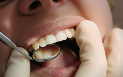 Чому болять всі зуби одночасно: причини та методи усунення болю
