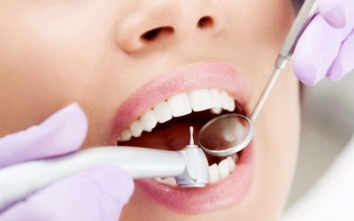 Чи можна лікувати зуби під час місячних: протипоказання та рекомендації