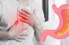 Печія і біль у шлунку: лікування, причини, симптоми