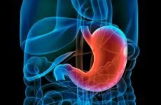 Причини лімфоїдного гастриту шлунка та методика його лікування