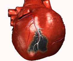 Препараты от тахикардии и сердцебиения которые помогут нормализовать ЧСС