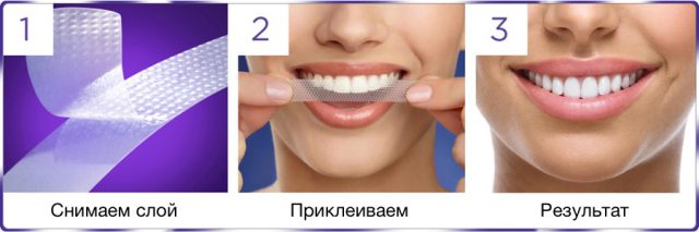 8 способів зробити зуби білішими