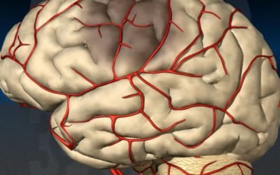 Транзиторна ішемічна атака головного мозку