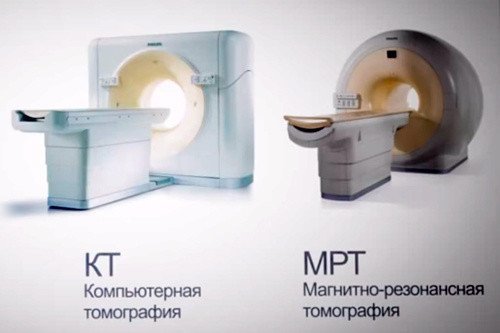 Что такое МРТ сосудов головного мозга и кто назначает процедуру