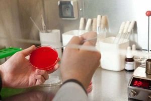 bakterialnyjj posev bak posev ehyakulyata na mikrofloru: pokazaniya k sdache analiza, kak sdavat, rezultaty