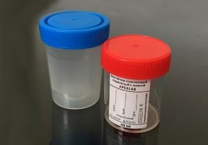 bakterialnyjj posev bak posev ehyakulyata na mikrofloru: pokazaniya k sdache analiza, kak sdavat, rezultaty1