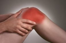 Хвороба Кеніга або розсікає остеохондрит колінного суглоба: МКБ-10, лікування, симптоми, причини, фото