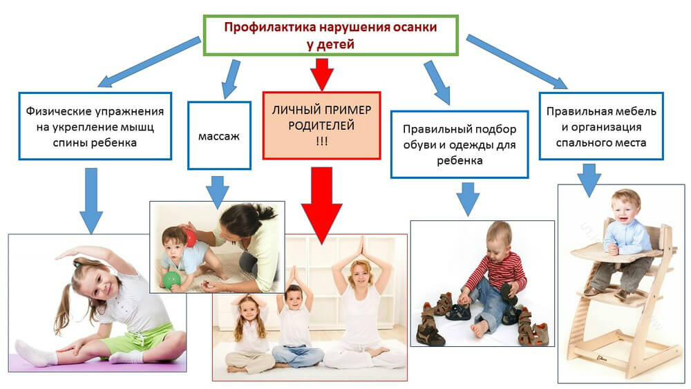 fizicheskie uprazhneniya dlya ispravleniya narushenijj osanki u detejj160