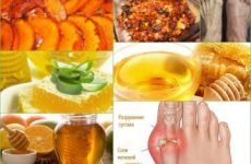 Як можна використовувати мед при подагрі: користь, ефективні рецепти, протипоказання