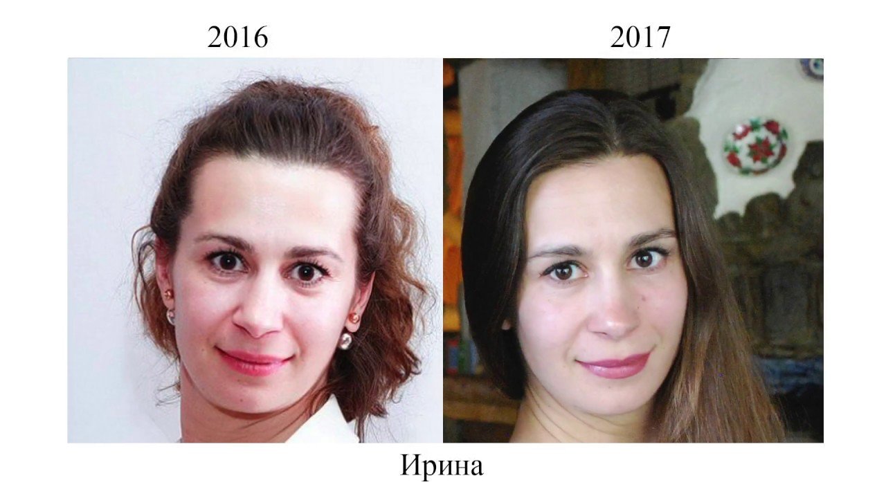 Фейсбилдинг Для Лица Отзывы Фото