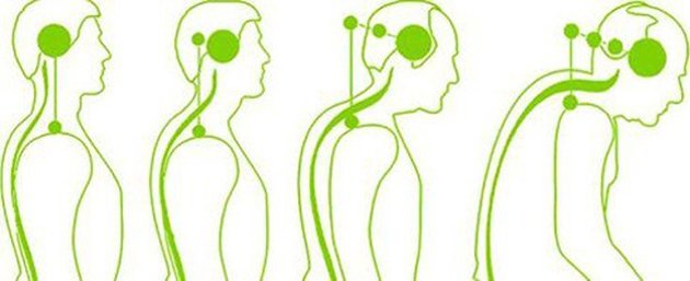 osteokhondroz shejjnogo otdela pozvonochnika: simptomy, priznaki u zhenshhin151