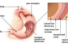 Резекція шлунка за Більрота 1,2: опис операції, показання до лікування, наслідки