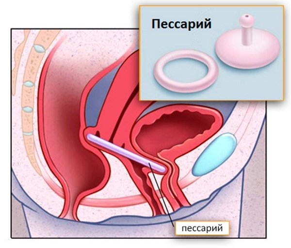 Темный Цвет Влагалища