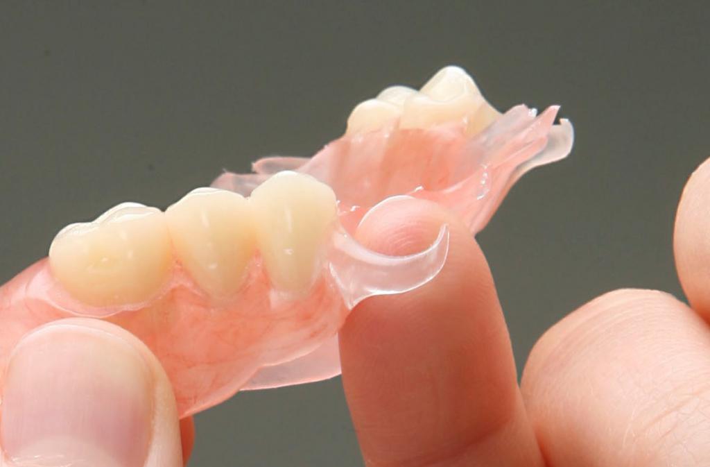 Навіщо ставлять тимчасові зубні протези?