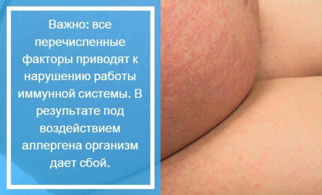 allergicheskijj vaskulit: klassifikaciya bolezni, prichiny i ee priznaki, lechenie patologii