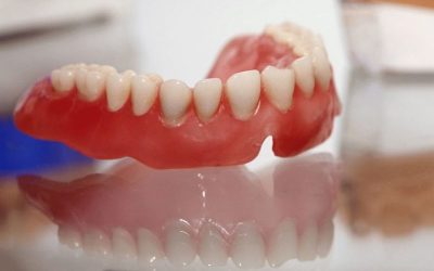 Що таке поліуретанові знімні зубні протези?