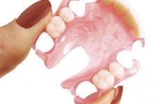 Як проводиться протезування зубів без обточування?