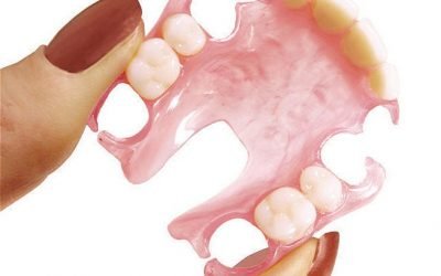 Як проводиться протезування зубів без обточування?
