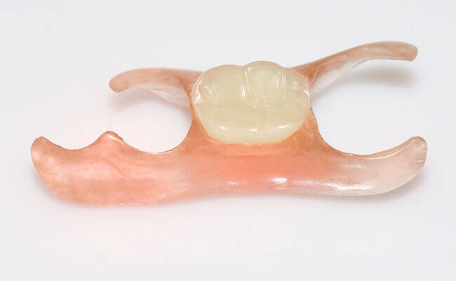 Чи можна встановити знімний протез на один зуб?