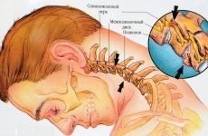 Шийний хондроз: діагностика захворювання і методи лікування