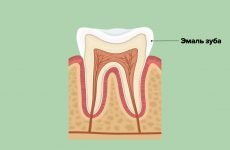 Чи можна і як зміцнити зубну емаль в домашніх умовах?